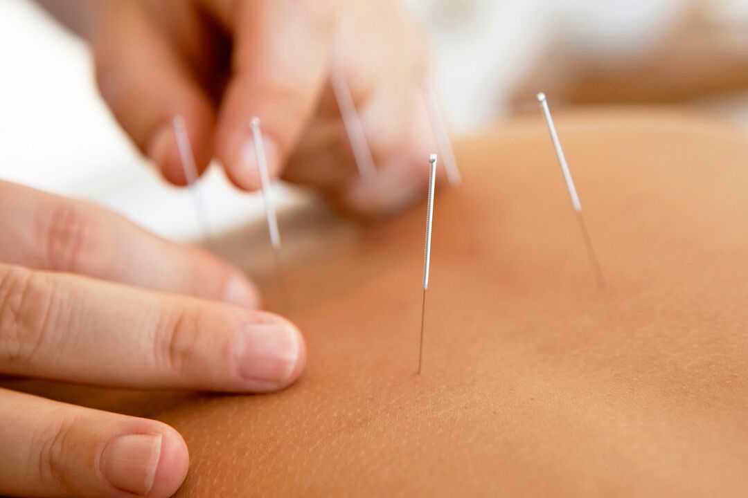 acupuntura para aumentar a potência