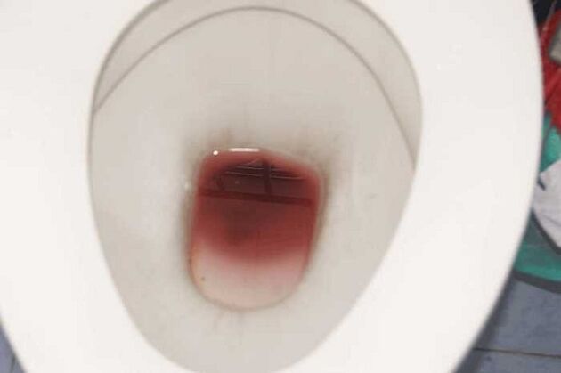 manchas em homens quando excitados